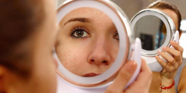 Kliande hud? 9 vanliga hudproblem – och vad du kan göra åt dem